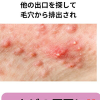 画像243