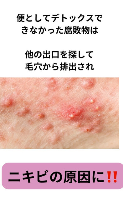 画像243
