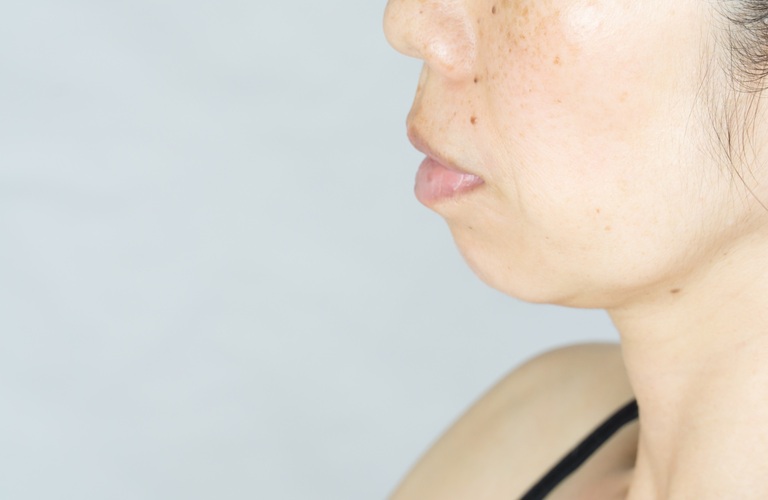 しみが気になる方 | 埼玉でエステならEmpreinte