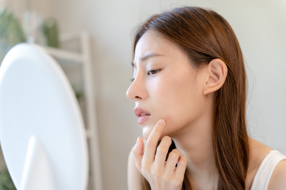 肌荒れを解消！美肌へ導く秘訣を伝授